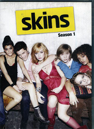 Skins 1